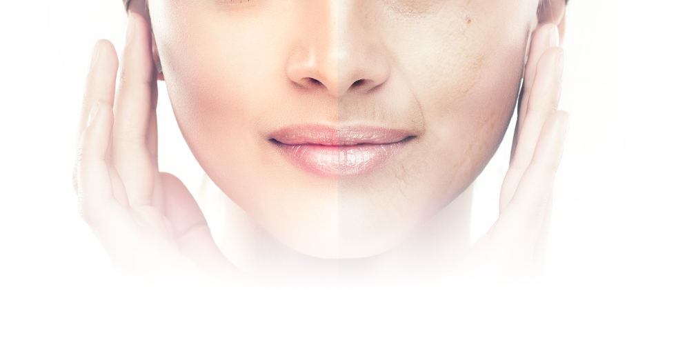 Dry Skin & Dry Wrinkles