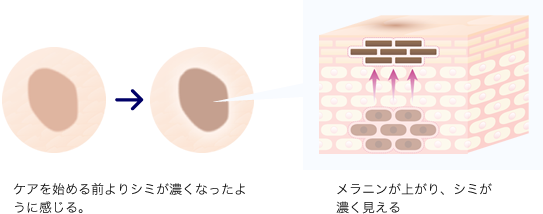 シミ過程