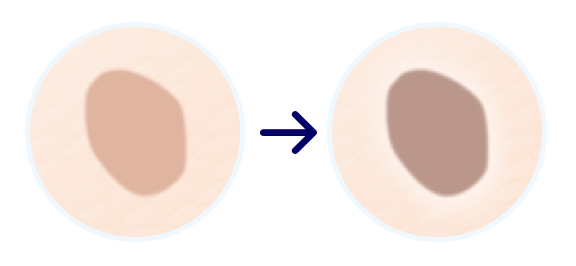 シミのない肌へのスタートライン。見逃していませんか?「シミの好転