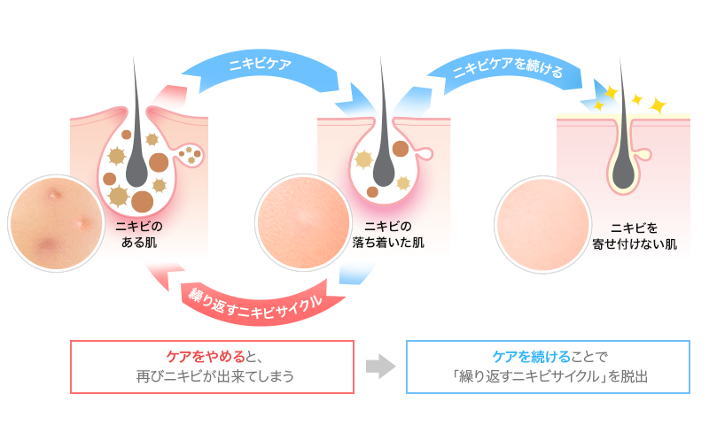 継続的なケアの必要性